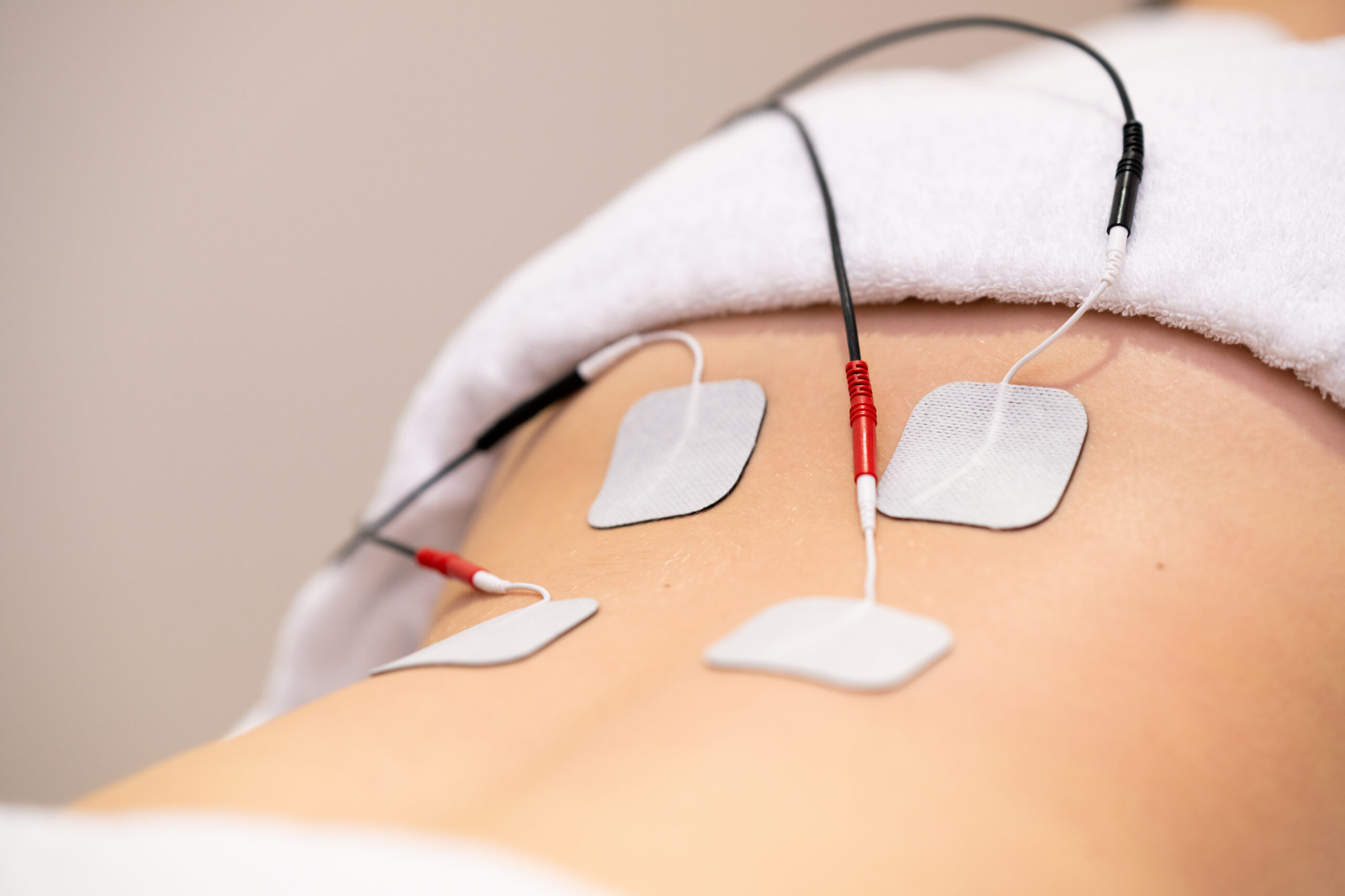 Electro stimulation in physical therapy to a young woman